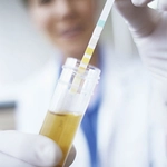 İdrarda Protein Kaçağı Belirtileri ve Tedavisi